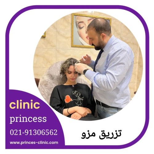 مزوتراپی